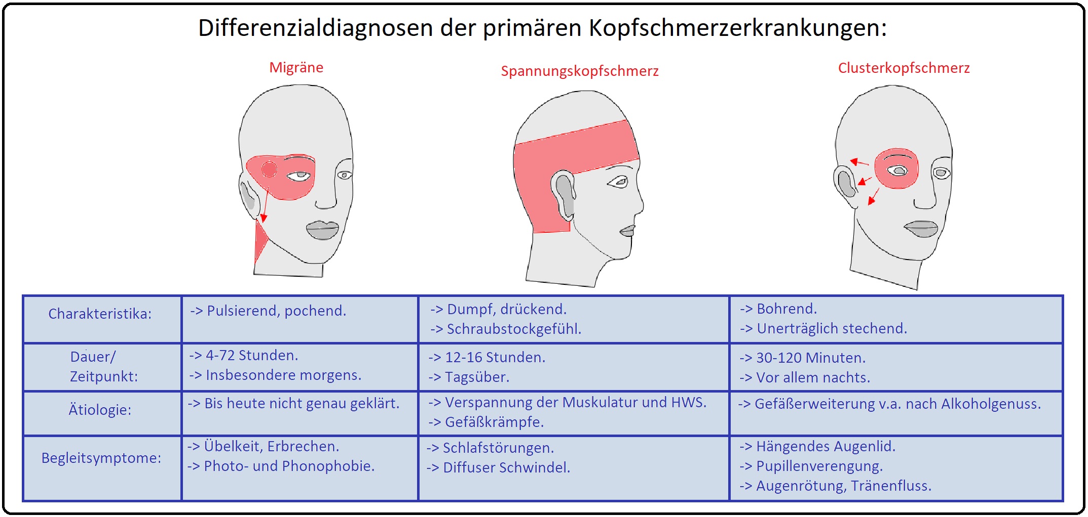 020 Differenzialdiagnosen der primären Kopfschmerzerkrankungen