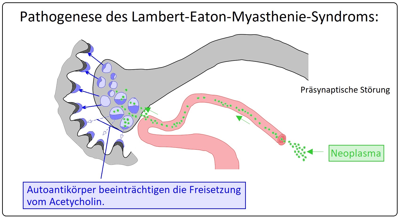 055 Pathogenese des Lambert Eaton Syndroms