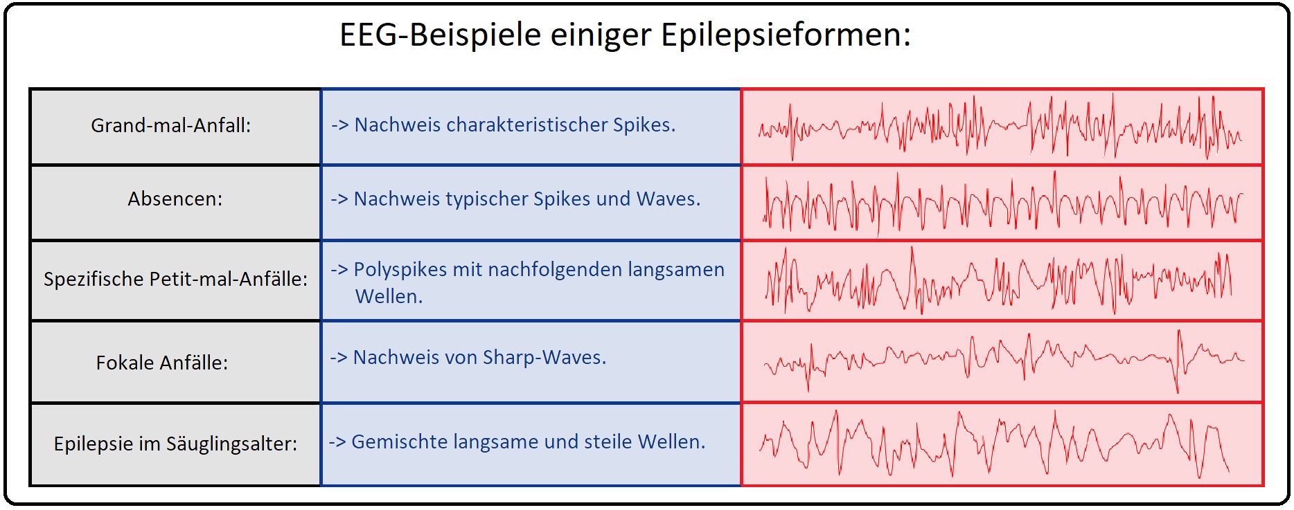 24 EEG Beispiele einiger Epilepsieformen